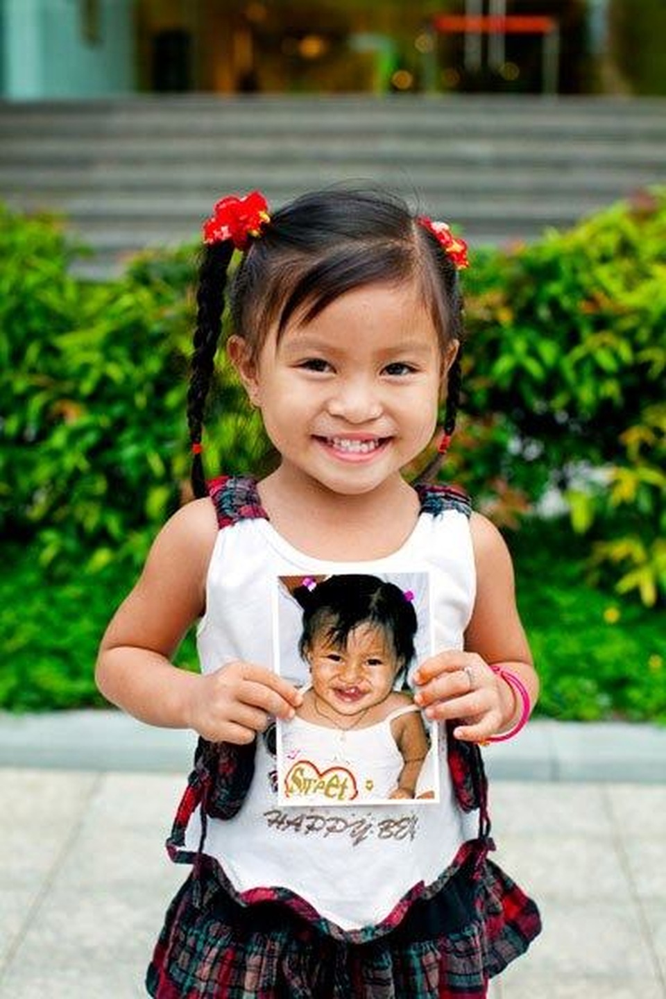 AQUA Việt Nam đồng hành cùng Operation Smile Việt Nam phẫu thuật miễn phí cho trẻ em dị tật vùng hàm mặt - 2 AQUA Việt Nam đồng hành cùng Operation Smile Việt Nam phẫu thuật miễn phí cho trẻ em dị tật vùng hàm mặt - 2