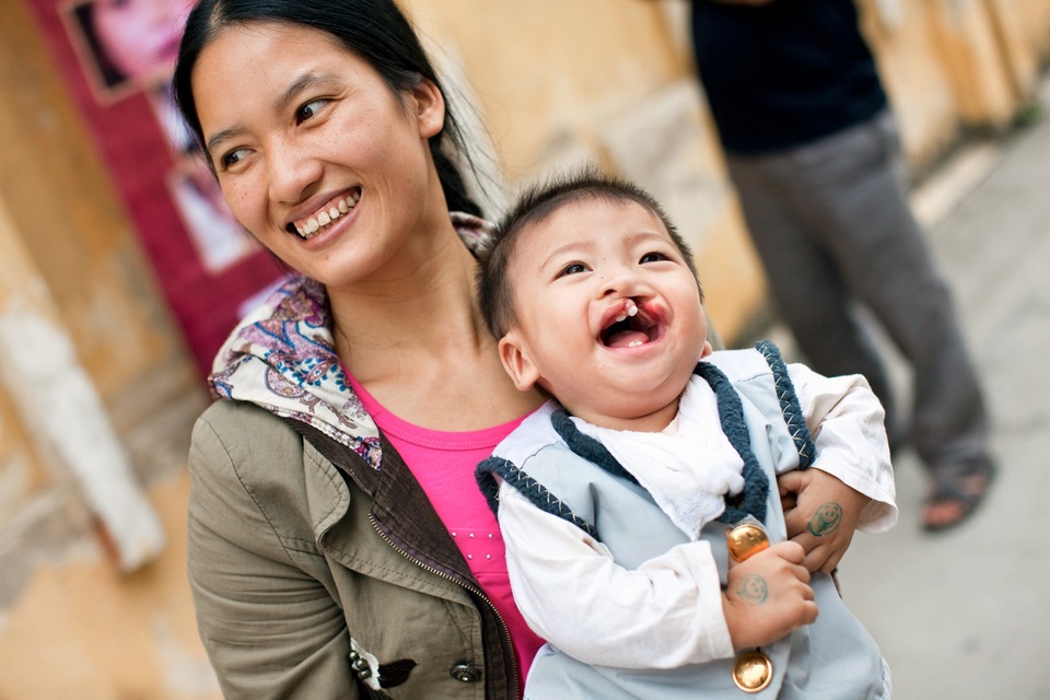 AQUA Việt Nam đồng hành cùng Operation Smile Việt Nam phẫu thuật miễn phí cho trẻ em dị tật vùng hàm mặt - 5 AQUA Việt Nam đồng hành cùng Operation Smile Việt Nam phẫu thuật miễn phí cho trẻ em dị tật vùng hàm mặt - 5