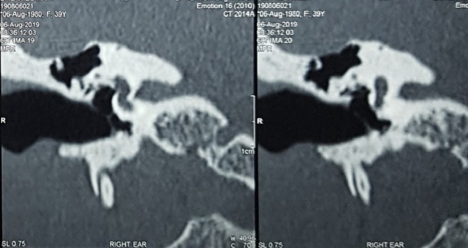 Mặc cảm bị thần kinh suốt 19 năm vì bác sĩ chẩn không đúng bệnh - 2
