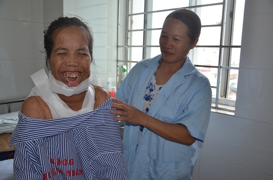 Người đàn bà mang hàm răng “kỳ dị” đã có “khuôn mặt mới” sau ca phẫu thuật - 8 Người đàn bà mang hàm răng “kỳ dị” đã có “khuôn mặt mới” sau ca phẫu thuật - 8