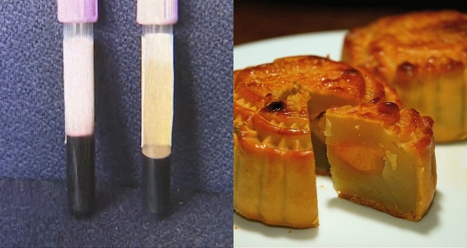 Máu chuyển sang màu trắng vì ăn 4 chiếc bánh Trung thu mỗi ngày - 1