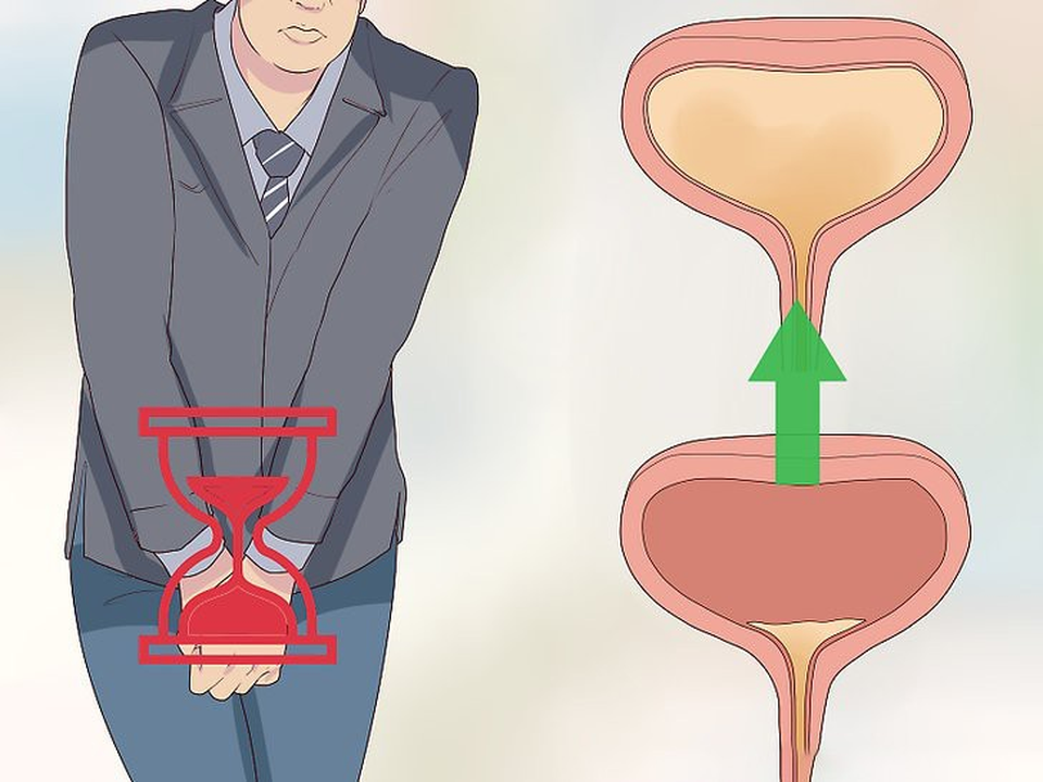 Bài tập Kegel và Thực phẩm bảo vệ sức khỏe Ích Tiểu Vương có tác dụng đối với người mắc tiểu nhiều lần như thế nào? - 2 Bài tập Kegel và Thực phẩm bảo vệ sức khỏe Ích Tiểu Vương có tác dụng đối với người mắc tiểu nhiều lần như thế nào? - 2