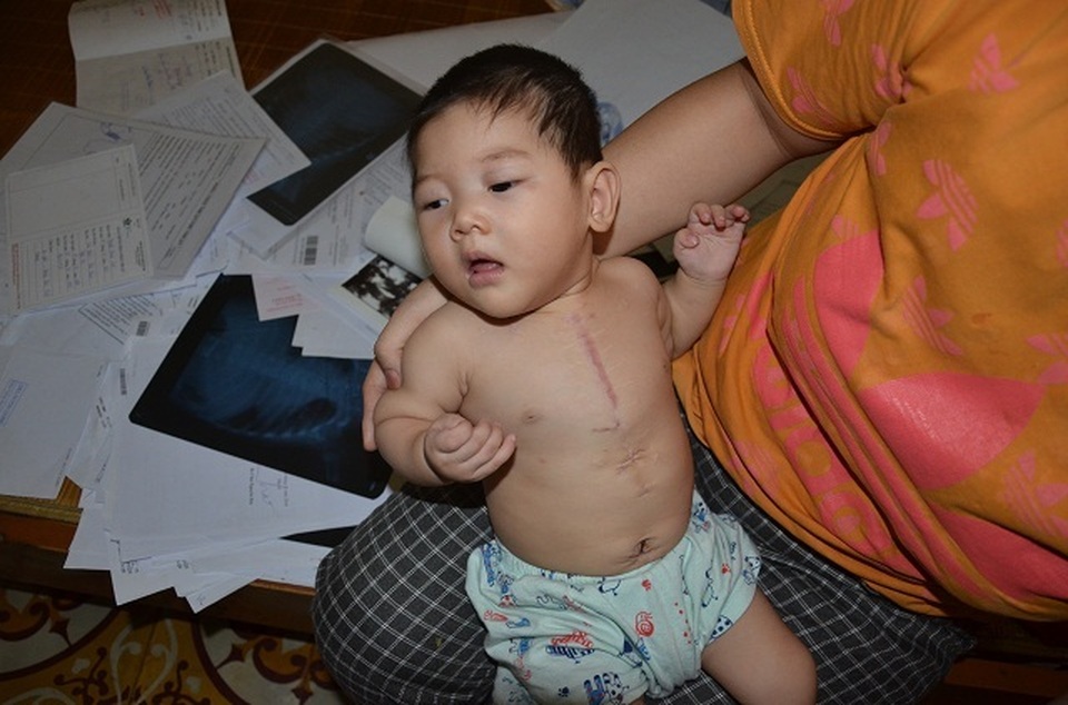 Bé gái 9 tháng tuổi bị tim bẩm sinh được bạn đọc giúp đỡ hơn 140 triệu đồng - 1 Bé gái 9 tháng tuổi bị tim bẩm sinh được bạn đọc giúp đỡ hơn 140 triệu đồng - 1