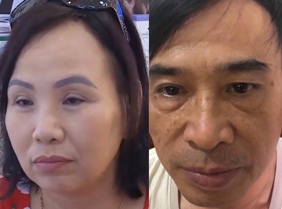 Haduhi xóa tan nỗi lo bọng mắt nếp nhăn chỉ với 2 phút mỗi ngày - 1 Haduhi xóa tan nỗi lo bọng mắt nếp nhăn chỉ với 2 phút mỗi ngày - 1