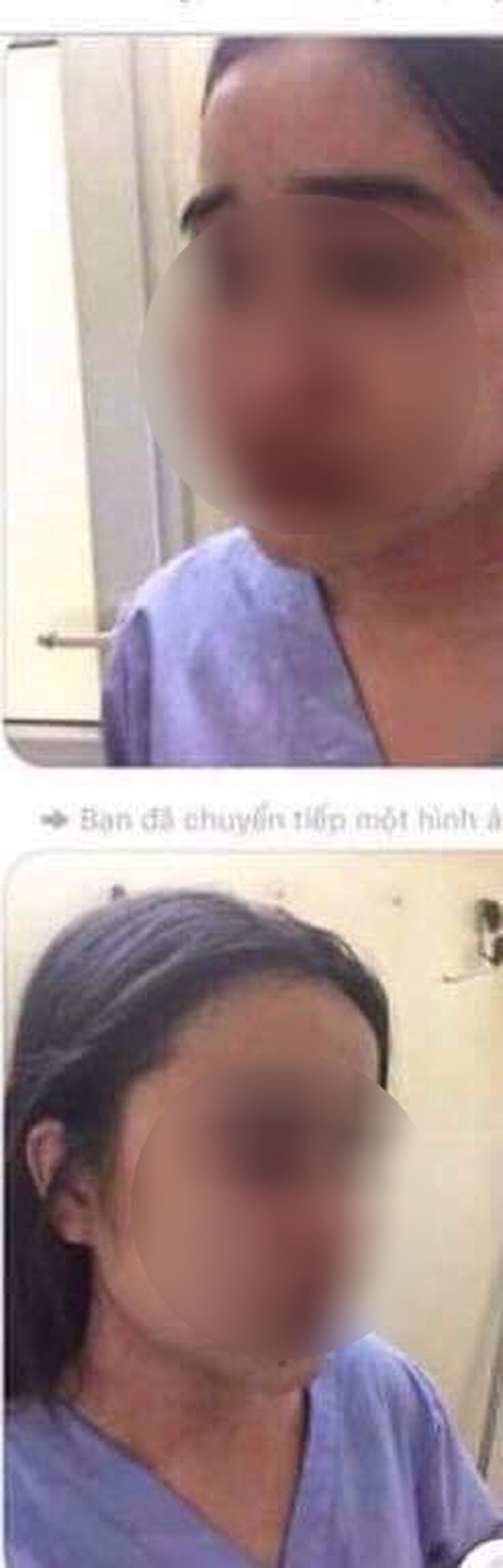 Nữ điều dưỡng đã chống cự, giằng co 1 tiếng trong phòng của bác sĩ sàm sỡ, gạ tình? - 3 Nữ điều dưỡng đã chống cự, giằng co 1 tiếng trong phòng của bác sĩ sàm sỡ, gạ tình? - 3