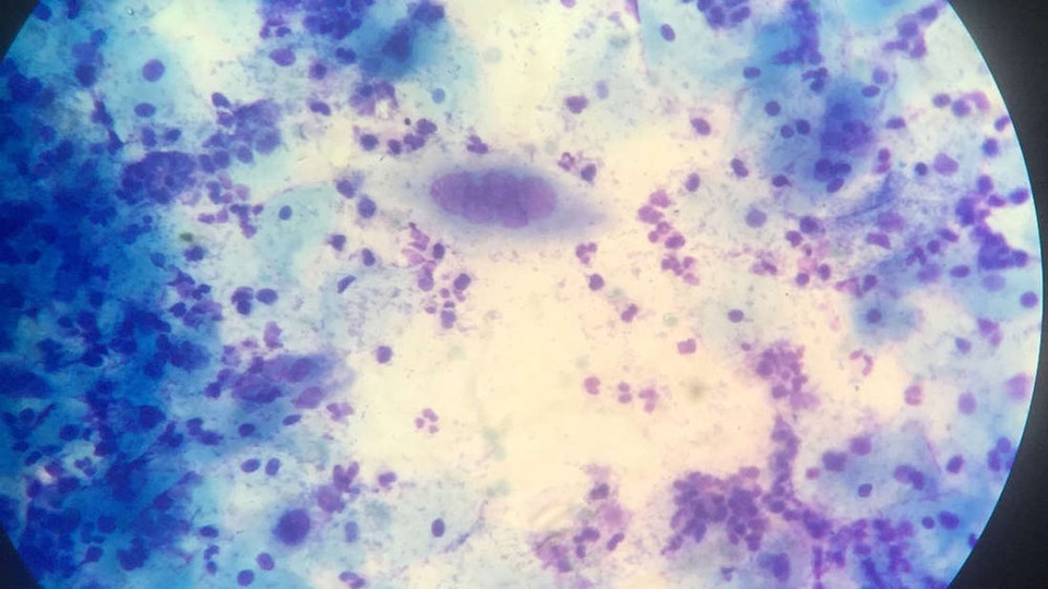 Vắc-xin herpes mới có thể sớm được đưa vào thử nghiệm ở người - 1 Vắc-xin herpes mới có thể sớm được đưa vào thử nghiệm ở người - 1