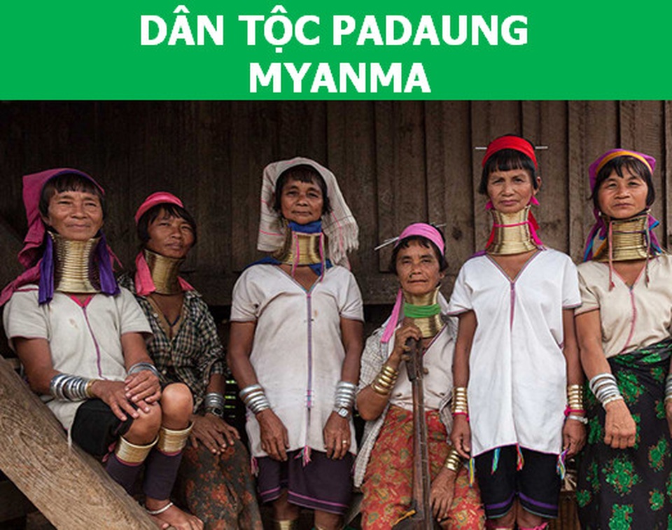 Những tiêu chuẩn sắc đẹp kỳ lạ của phụ nữ trên thế giới - 2 Những tiêu chuẩn sắc đẹp kỳ lạ của phụ nữ trên thế giới - 2