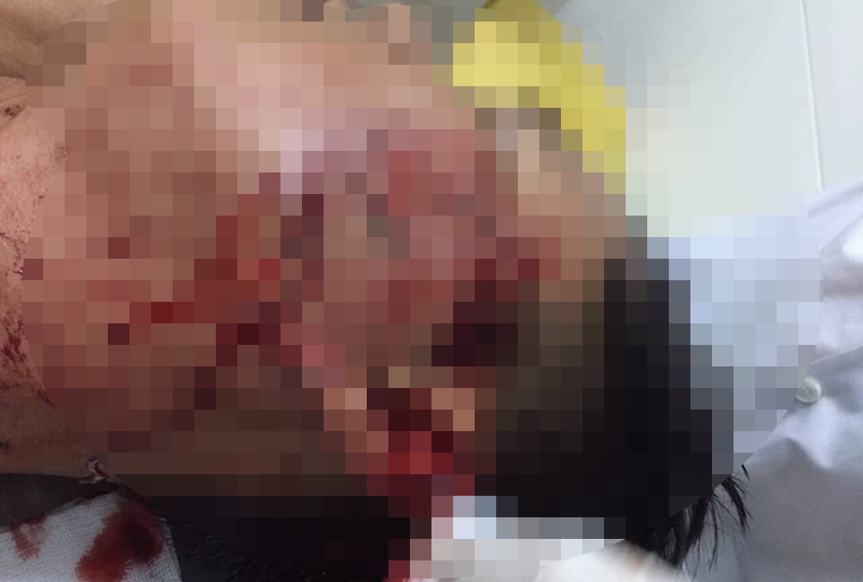 Khởi tố đối tượng đập ly bia vào mặt Đại úy CSGT - 1 Khởi tố đối tượng đập ly bia vào mặt Đại úy CSGT - 1