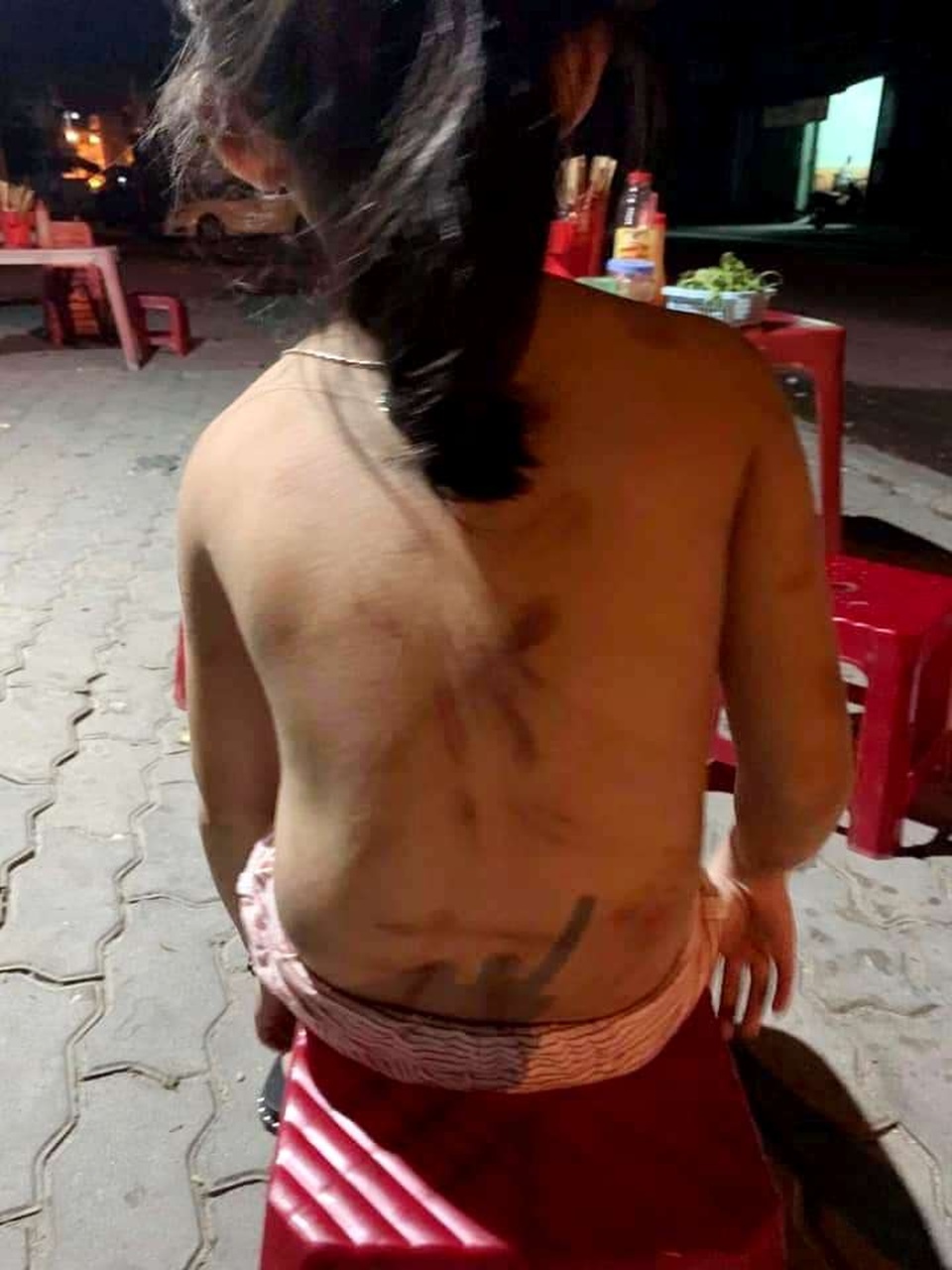 Cháu bé 6 tuổi ở Quảng Nam bị hành hạ Cháu bé 6 tuổi ở Quảng Nam bị hành hạ