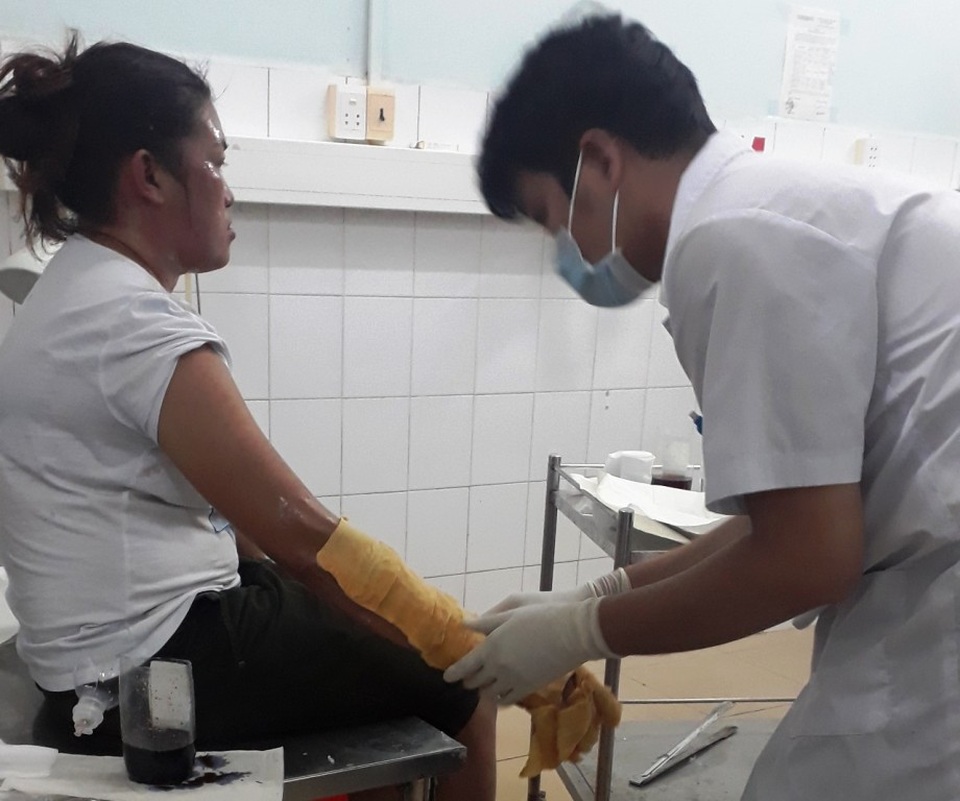 Nổ bình gas mini ở chợ đêm Phú Quốc, nhiều du khách bị bỏng - 1
Nhân viên y tế Bệnh viện Đa khoa Phú Quốc chăm sóc cho một thực khách bị bỏng.
