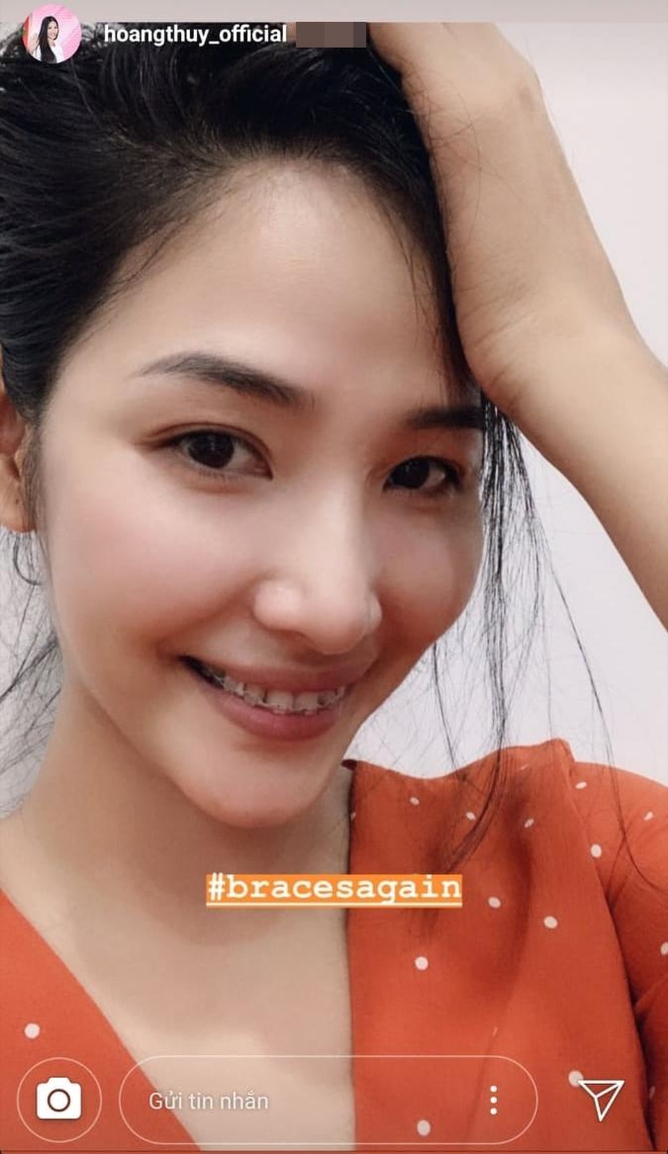 Hoàng Thuỳ khoe nhan sắc “lên hương” nhờ chỉnh răng trước thềm Miss Universe 2019 - 4 Hoàng Thuỳ khoe nhan sắc “lên hương” nhờ chỉnh răng trước thềm Miss Universe 2019 - 4