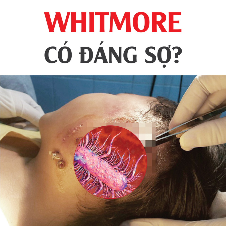 Bác sỹ đầu ngành chia sẻ cách ứng phó và dự phòng nỗi khiếp sợ mang tên Withmore - 1 Bác sỹ đầu ngành chia sẻ cách ứng phó và dự phòng nỗi khiếp sợ mang tên Withmore - 1