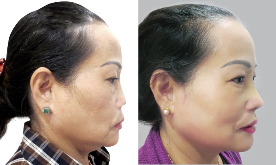 Hiện trạng thẩm mỹ ở Việt Nam qua góc nhìn của chuyên gia thế giới - 5 Hiện trạng thẩm mỹ ở Việt Nam qua góc nhìn của chuyên gia thế giới - 5