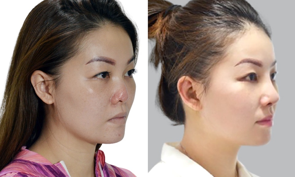 Hiện trạng thẩm mỹ ở Việt Nam qua góc nhìn của chuyên gia thế giới - 7 Hiện trạng thẩm mỹ ở Việt Nam qua góc nhìn của chuyên gia thế giới - 7