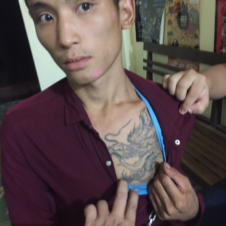 Lên cơn nghiện, nam thanh niên cầm dao kề cổ người phụ nữ cướp xe máy - 1