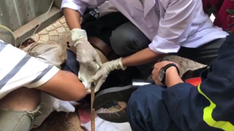 Thanh sắt rơi từ trên cao, xuyên qua hông người đàn ông - 2 Thanh sắt rơi từ trên cao, xuyên qua hông người đàn ông - 2