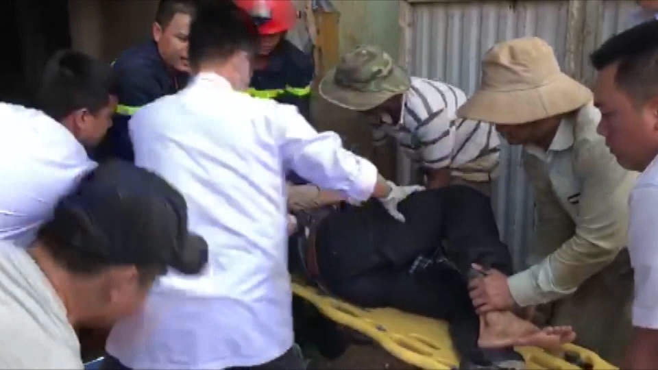 Thanh sắt rơi từ trên cao, xuyên qua hông người đàn ông - 1 Thanh sắt rơi từ trên cao, xuyên qua hông người đàn ông - 1