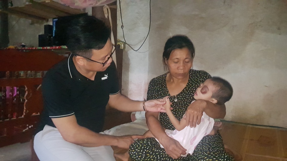 Bé gái có cặp mắt như quả bóng muốn nổ tung cầu cứu...! - 3 Bé gái có cặp mắt như quả bóng muốn nổ tung cầu cứu...! - 3