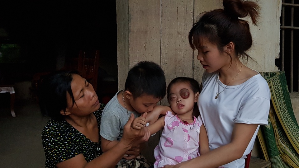 Bé gái có cặp mắt như quả bóng muốn nổ tung cầu cứu...! - 9 Bé gái có cặp mắt như quả bóng muốn nổ tung cầu cứu...! - 9
