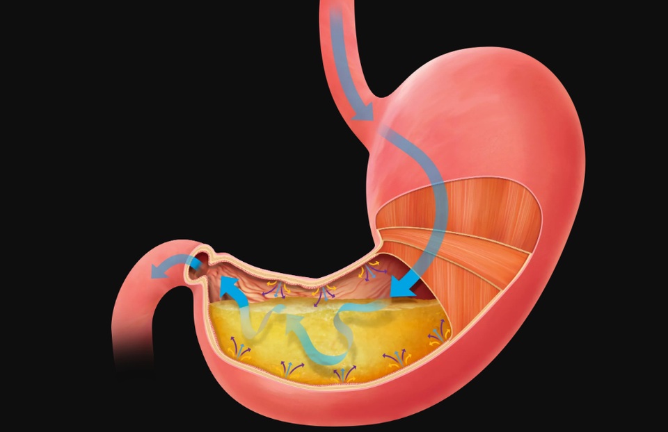 Điều kinh hoàng gì sẽ xảy ra nếu bạn rơi vào một chiếc bể chứa đầy dịch vị dạ dày? - 2