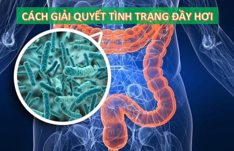Những mẹo giải quyết tình trạng đầy hơi, chướng bụng ngay tại nhà - 2 Những mẹo giải quyết tình trạng đầy hơi, chướng bụng ngay tại nhà - 2