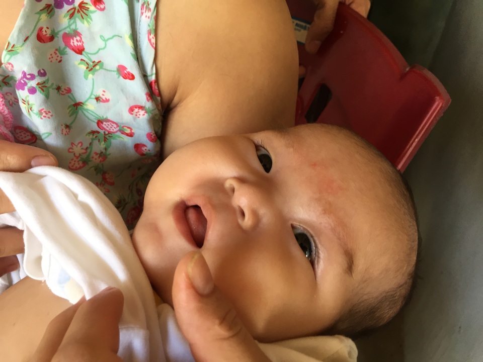 Ánh mắt cầu cứu của bé gái 5 tháng tuổi bị ung thư máu - 3 Ánh mắt cầu cứu của bé gái 5 tháng tuổi bị ung thư máu - 3