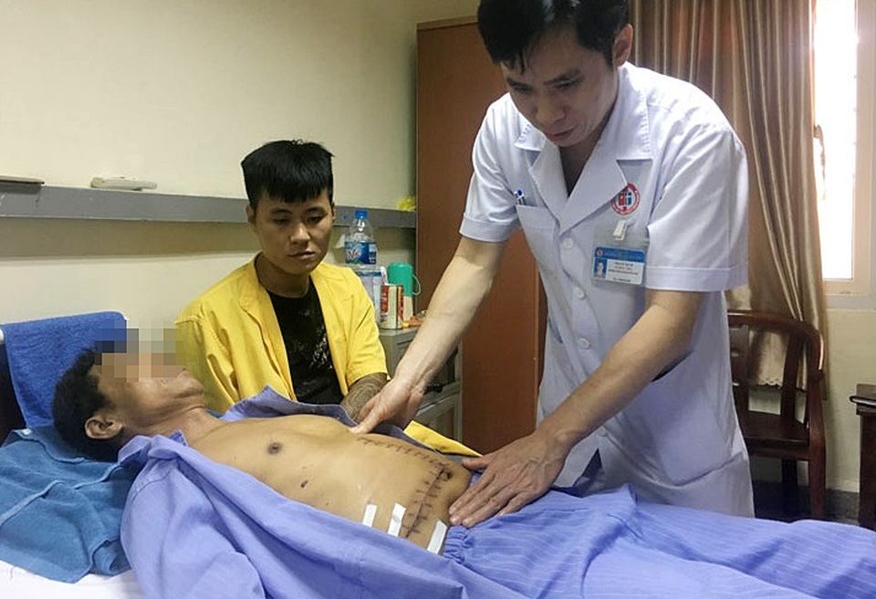 Người đàn ông sút 9kg, tưởng sỏi đường mật hoá ung thư hiếm gặp - 1 Người đàn ông sút 9kg, tưởng sỏi đường mật hoá ung thư hiếm gặp - 1