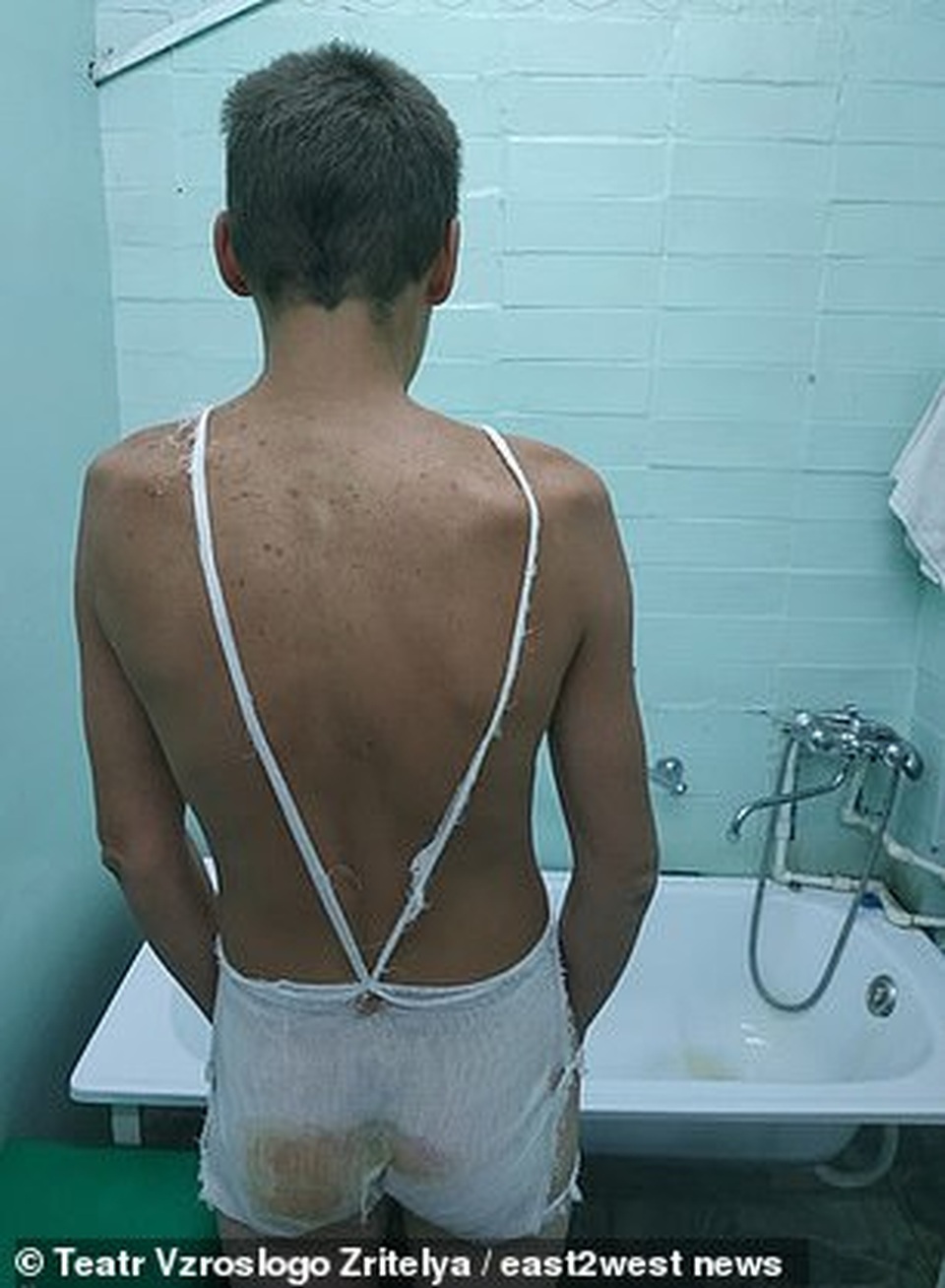 Nghi phạm bỏng rộp mông khi hỏi cung, 3 cảnh sát bị truy tố - 2 Nghi phạm bỏng rộp mông khi hỏi cung, 3 cảnh sát bị truy tố - 2