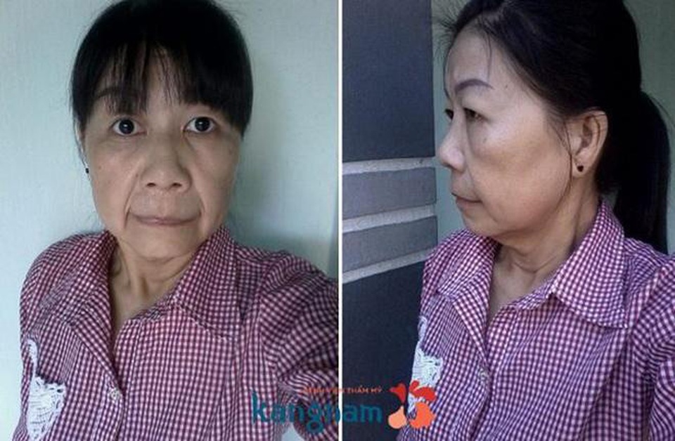 Câu chuyện về người phụ nữ cải lão hoàn đồng và phép màu đến từ lòng nhân ái - 2 Câu chuyện về người phụ nữ cải lão hoàn đồng và phép màu đến từ lòng nhân ái - 2