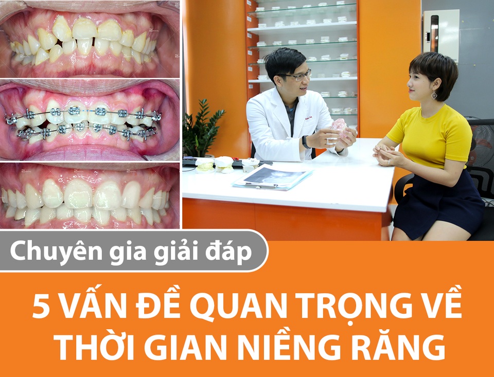 Thời gian niềng răng: 5 vấn đề quan trọng được chuyên gia giải đáp - 1