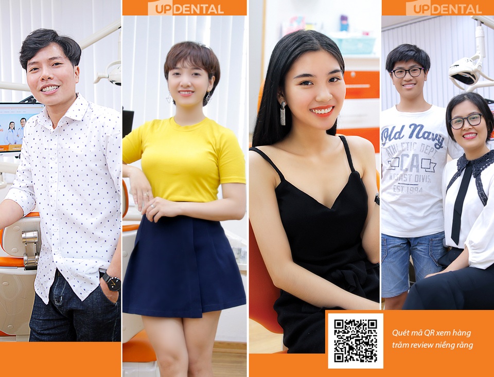 Thời gian niềng răng: 5 vấn đề quan trọng được chuyên gia giải đáp - 4