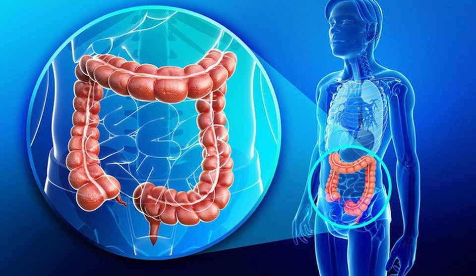 5 dấu hiệu thầm lặng của ung thư đại tràng - 1 5 dấu hiệu thầm lặng của ung thư đại tràng - 1