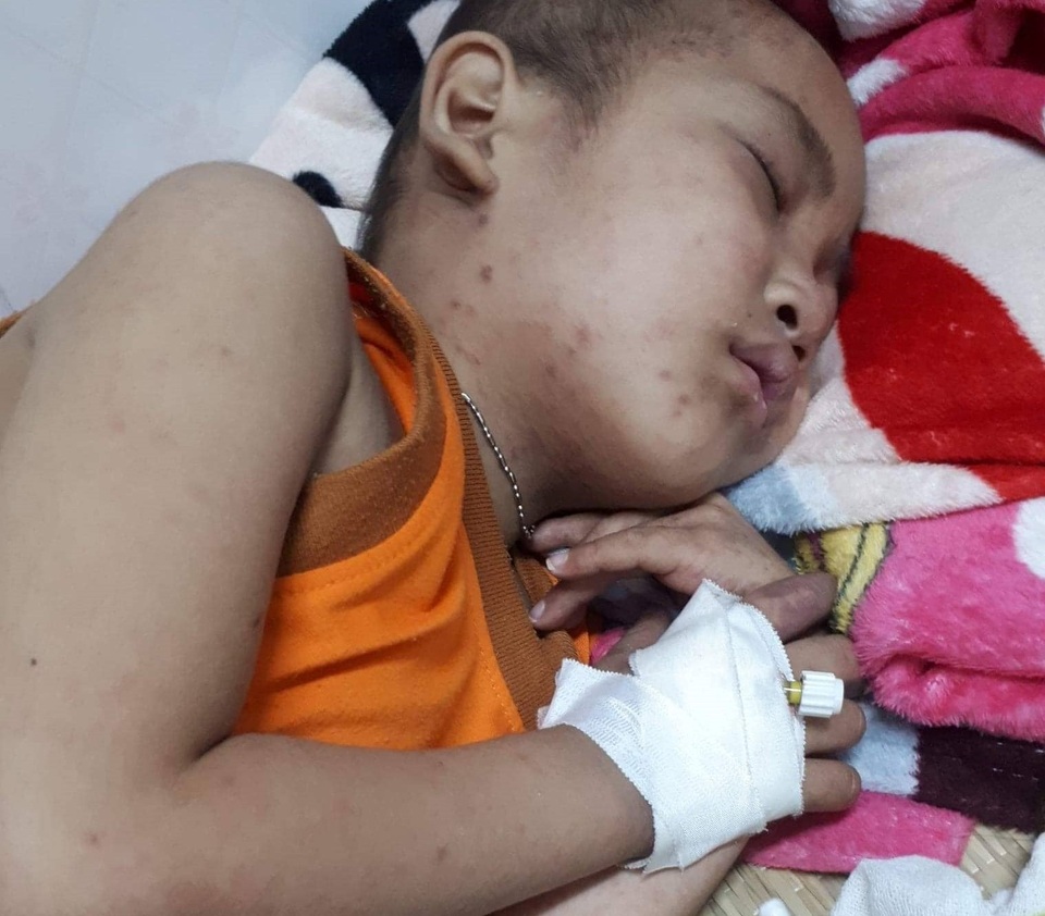 Nhìn em trai đau đớn, chị đòi nghỉ học đi làm kiếm tiền chữa bệnh cho em - 2