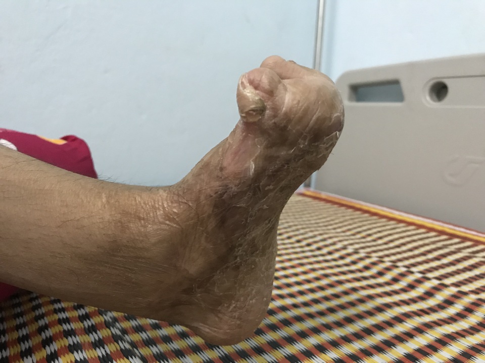 Người mẹ một chân khóc nghẹn ngào ước mơ trở về bên đứa con bé bỏng! - 8 Người mẹ một chân khóc nghẹn ngào ước mơ trở về bên đứa con bé bỏng! - 8