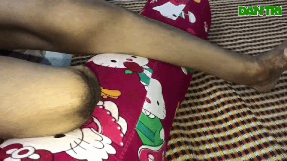 Người mẹ một chân khóc nghẹn ngào ước mơ trở về bên đứa con bé bỏng! - 7 Người mẹ một chân khóc nghẹn ngào ước mơ trở về bên đứa con bé bỏng! - 7