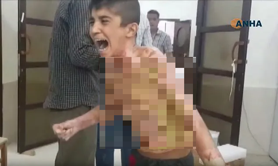 Những đứa trẻ Syria bị trúng bom trong chiến sự dữ dội của Thổ Nhĩ Kỳ - 1 Những đứa trẻ Syria bị trúng bom trong chiến sự dữ dội của Thổ Nhĩ Kỳ - 1