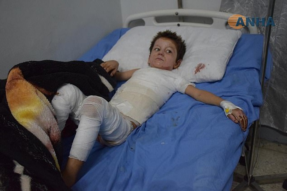 Những đứa trẻ Syria bị trúng bom trong chiến sự dữ dội của Thổ Nhĩ Kỳ - 3 Những đứa trẻ Syria bị trúng bom trong chiến sự dữ dội của Thổ Nhĩ Kỳ - 3