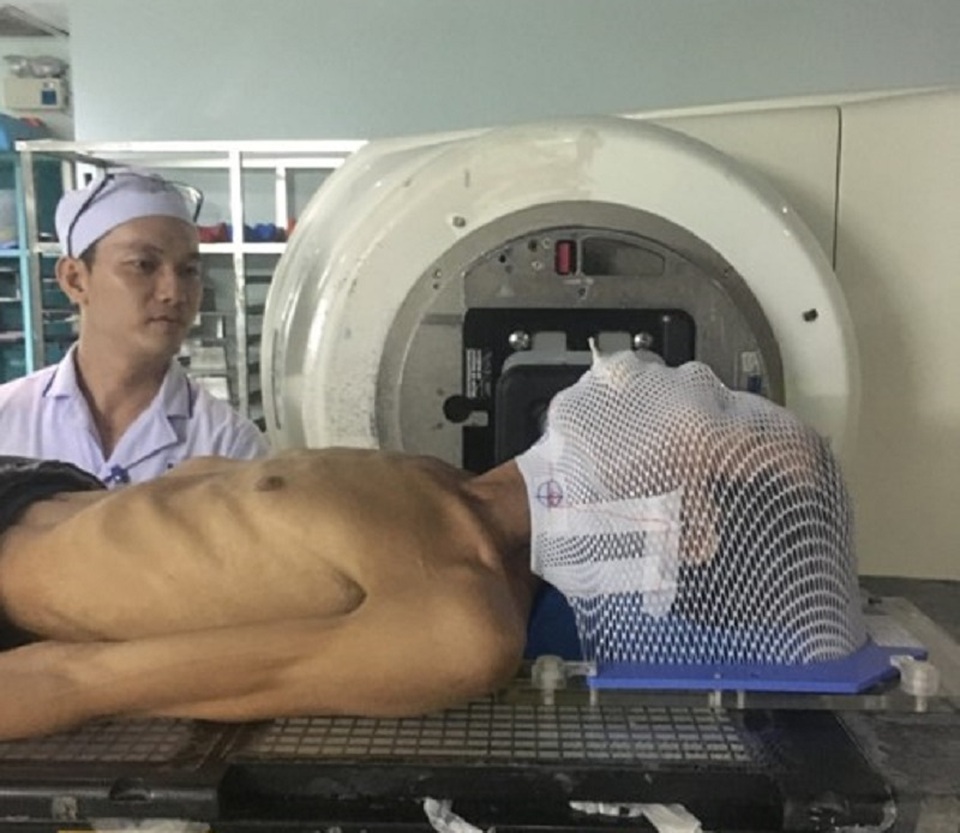 Nhiều người bỗng nhiên phải cắt lưỡi vì ung thư - 2 Nhiều người bỗng nhiên phải cắt lưỡi vì ung thư - 2