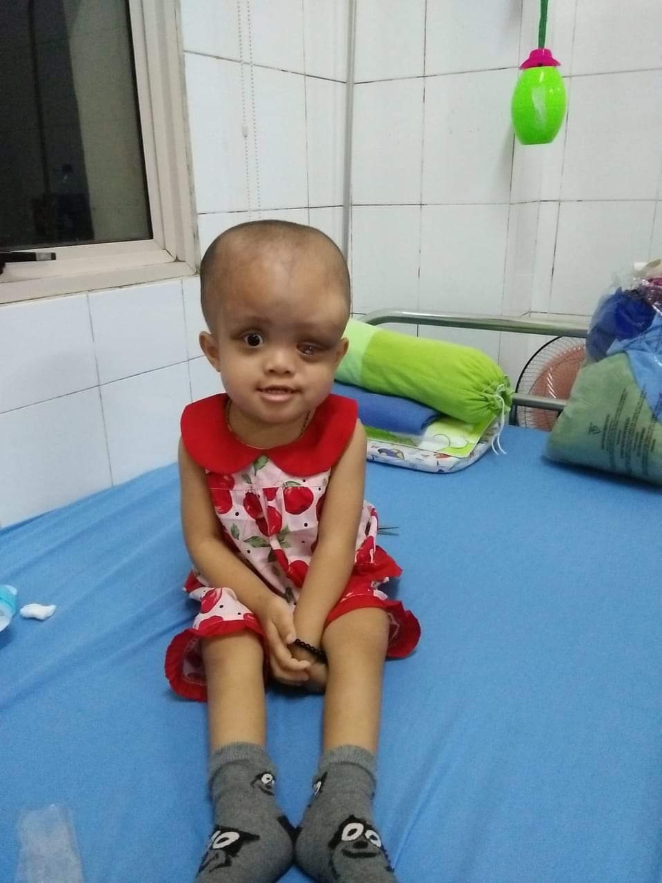 Nhìn bé gái bị ung thư hành hạ hỏng một mắt mà lòng tôi như quặn lại! - 5 Nhìn bé gái bị ung thư hành hạ hỏng một mắt mà lòng tôi như quặn lại! - 5
