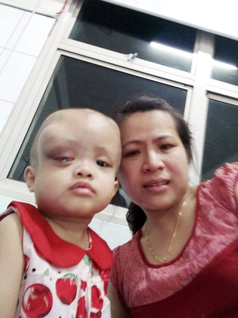 Nhìn bé gái bị ung thư hành hạ hỏng một mắt mà lòng tôi như quặn lại! - 4 Nhìn bé gái bị ung thư hành hạ hỏng một mắt mà lòng tôi như quặn lại! - 4