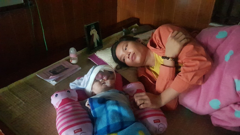 Bé gái mang u khủng dị thường trên mặt ra đi trong nỗi xót xa! - 2 Bé gái mang u khủng dị thường trên mặt ra đi trong nỗi xót xa! - 2
