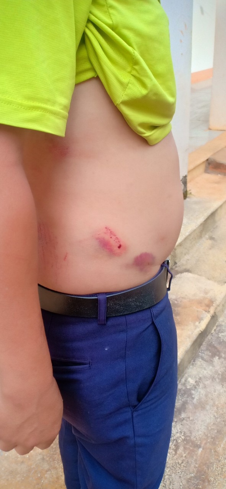 Chánh Văn phòng Huyện ủy đánh tài xế cơ quan nhập viện - 2