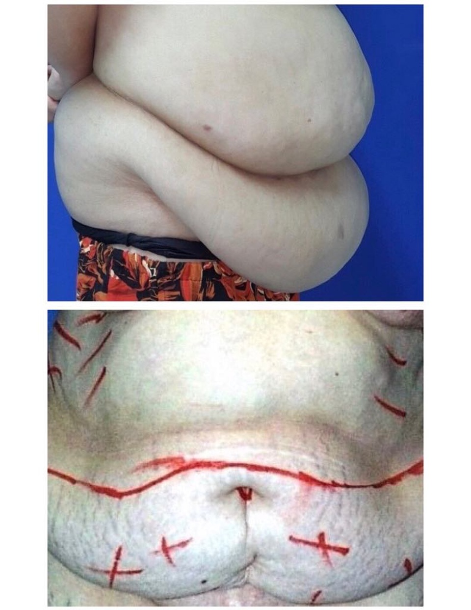 Bà mẹ 2 con thoát khỏi cảnh “mẹ sề” sau khi giảm 20 kg - 1 Bà mẹ 2 con thoát khỏi cảnh “mẹ sề” sau khi giảm 20 kg - 1