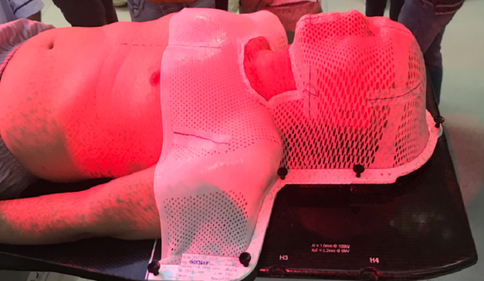 Trí tuệ nhân tạo giúp hạn chế sai sót trong điều trị ung thư - 2 Trí tuệ nhân tạo giúp hạn chế sai sót trong điều trị ung thư - 2