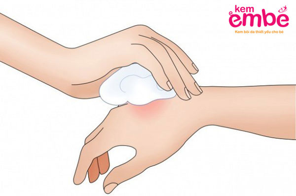 Bác sĩ da liễu cảnh báo 3 sai lầm nghiêm trọng 80% mẹ bỉm sữa mắc phải khi trẻ bị côn trùng cắn sưng đỏ - 4 Bác sĩ da liễu cảnh báo 3 sai lầm nghiêm trọng 80% mẹ bỉm sữa mắc phải khi trẻ bị côn trùng cắn sưng đỏ - 4