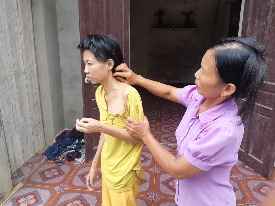 Xót xa người phụ nữ gồng mình chịu cảnh hai người tâm thần trong gia đình hành hạ - 6 Xót xa người phụ nữ gồng mình chịu cảnh hai người tâm thần trong gia đình hành hạ - 6