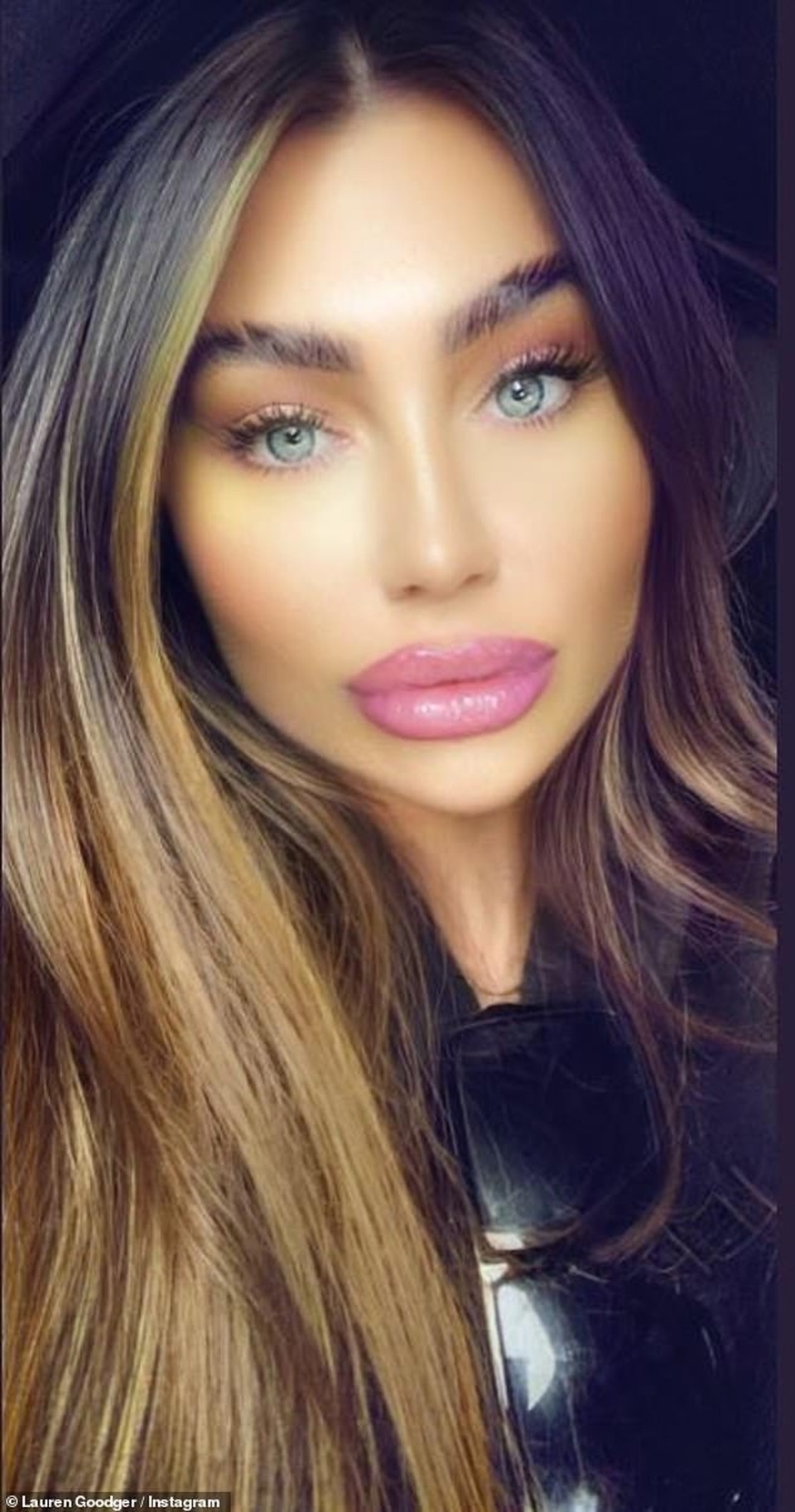 Fans khuyên Lauren Goodger dừng bơm môi - 1 Fans khuyên Lauren Goodger dừng bơm môi - 1