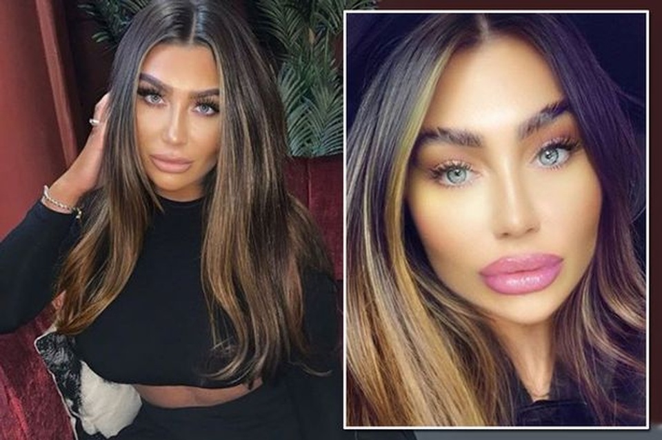 Fans khuyên Lauren Goodger dừng bơm môi - 2 Fans khuyên Lauren Goodger dừng bơm môi - 2
