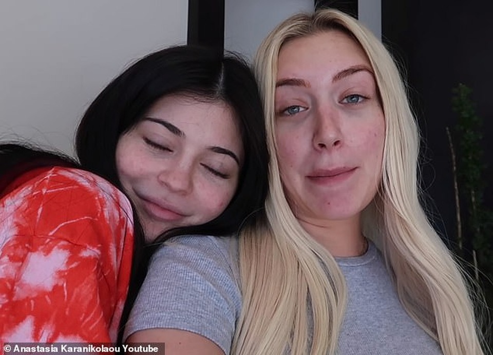 Kylie Jenner quá khác lạ khi thiếu son phấn - 2 Kylie Jenner quá khác lạ khi thiếu son phấn - 2
