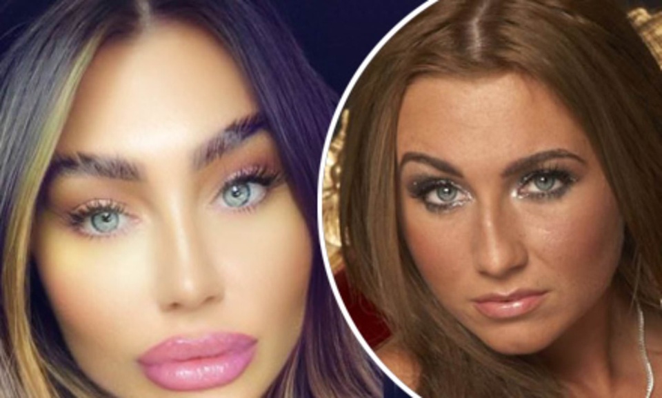 Fans khuyên Lauren Goodger dừng bơm môi - 4 Fans khuyên Lauren Goodger dừng bơm môi - 4